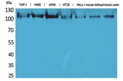 Western Blot analysis of THP-1, H460, A549, HT29, HeLa,mouse kidney, mouse colon cells using cPLA2 Polyclonal Antibody. Secondary antibody was diluted at 1:20000