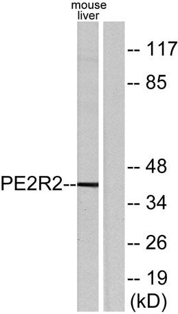 Western blot analysis of lysates from mouse liver, using PE2R2 Antibody. The lane on the right is blocked with the synthesized peptide.