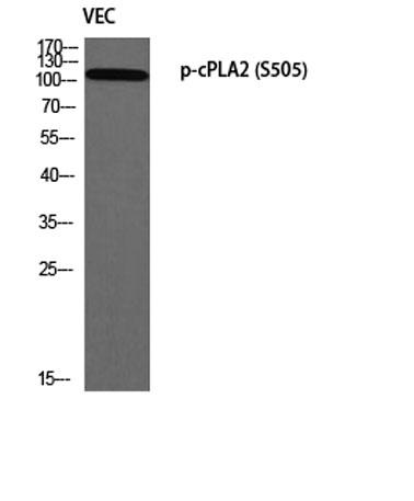 Western blot analysis of VEC using p-cPLA2 (S505)antibody. Antibody was diluted at 1:1000