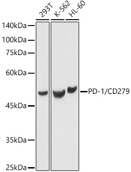 Western blot analysis of various lysates using PD-1/CD279 Rabbit pAb  at 1:1000 dilution.
Secondary antibody: HRP-conjugated Goat anti-Rabbit IgG (H+L)  at 1:10000 dilution.
Lysates/proteins: 25μg per lane.
Blocking buffer: 3% nonfat dry milk in TBST.
Detection: ECL West Pico Plus.
Exposure time: 1s.