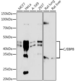 Western blot analysis of extracts of various cell lines, using C/EBPB antibody at 1:1000 dilution.
Secondary antibody: HRP Goat Anti-Rabbit IgG (H+L) at 1:10000 dilution.
Lysates/proteins: 25μg per lane.
Blocking buffer: 3% nonfat dry milk in TBST.
Detection: ECL West Pico Plus.
Exposure time: 1s.