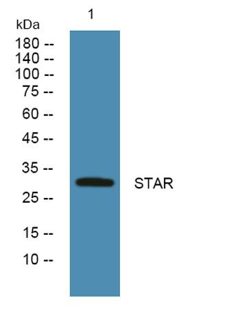 Western blot analysis of lysates from SH-SY5Y cells, primary antibody was diluted at 1:1000, 4°over night