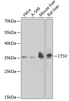 Western blot analysis of extracts of various cell lines, using CTSV antibody  at 1:1000 dilution.
Secondary antibody: HRP Goat Anti-Rabbit IgG (H+L) at 1:10000 dilution.
Lysates/proteins: 25μg per lane.
Blocking buffer: 3% nonfat dry milk in TBST.
Detection: ECLWest Pico Plus
Exposure time: 30s.
