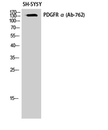 Western Blot analysis of SH-SY5Y cells using PDGFR-α Polyclonal Antibody