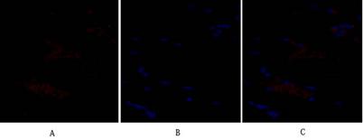 Immunofluorescence analysis of rat-heart tissue. 1,SNAI 1 Polyclonal Antibody(red) was diluted at 1:200(4°C,overnight). 2, Cy3 labled Secondary antibody
was diluted at 1:300(room temperature, 50min).3, Picture B: DAPI(blue) 10min. Picture A:Target.