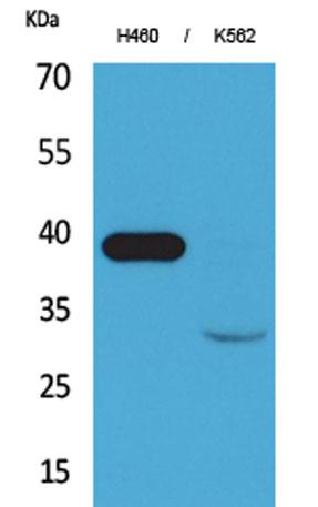 Western Blot analysis of H460, K562 cells using Cathepsin L Polyclonal Antibody. Secondary antibody was diluted at 1:20000