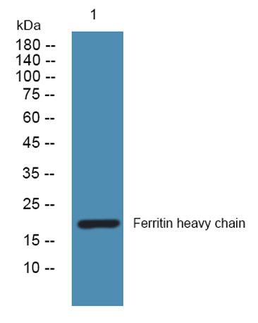 Western blot analysis of lysates from SH-SY5Y cells, primary antibody was diluted at 1:1000, 4°over night