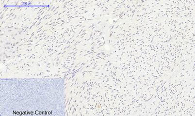 Immunohistochemical analysis of paraffin-embedded  Human-uterus tissue. Histone H2A Polyclonal Antibody was diluted at 1:200(4°C,overnight).  Sodium citrate pH 6.0 was used for antibody retrieval(>98°C,20min).Secondary antibody was diluted at 1:200