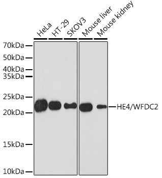 Western blot analysis of extracts of various cell lines, using HE4/WFDC2 Rabbit mAb at 1:1000 dilution.
Secondary antibody: HRP Goat Anti-Rabbit IgG (H+L) at 1:10000 dilution.
Lysates/proteins: 25μg per lane.
Blocking buffer: 3% nonfat dry milk in TBST.
Detection: ECL West Pico Plus.
Exposure time: 3min.