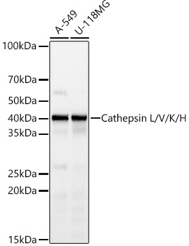 Western blot analysis of various lysates, using Cathepsin L/V/K/H Rabbit mAbat 1:1000 dilution.
Secondary antibody: HRP Goat Anti-Rabbit IgG (H+L) at 1:10000 dilution.
Lysates/proteins: 25μg per lane.
Blocking buffer: 3% nonfat dry milk in TBST.
Detection: ECL West Pico Plus.
Exposure time: 10s.