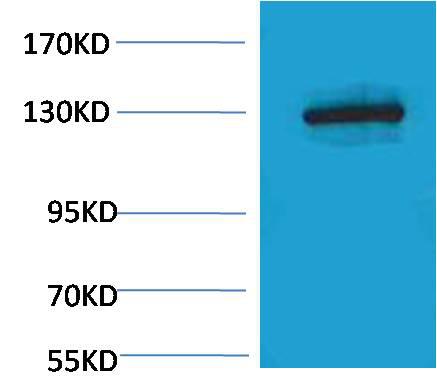 Western blot analysis of Hela, with E-Cadherin Rabbit Polyclonal Antibody diluted at 1:2,000.
