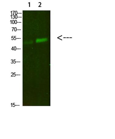 Western Blot analysis of 1,mouse-lung 2,mouse-kidneycells using primary antibody diluted at 1:500(4°Covernight). Secondary antibody:Goat Anti-rabbit IgG
IRDye 800( diluted at 1:5000, 25°C, 1 hour)