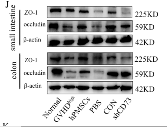 Human placental mesenchymal stromal cells modulate IFN-γ and IL-10 secretion by CD4+T cells via CD73, and alleviate intestinal damage in mice with graft-versus-host disease.