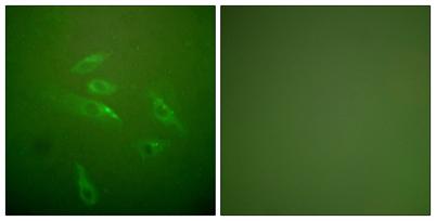 Immunofluorescence analysis of HeLa cells, using Collagen III Antibody. The picture on the right is blocked with the synthesized peptide.