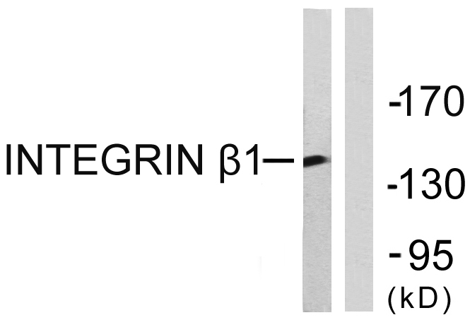 Western blot analysis of lysates from Jurkat cells, using Integrin beta1 Antibody. The lane on the right is blocked with the synthesized peptide.