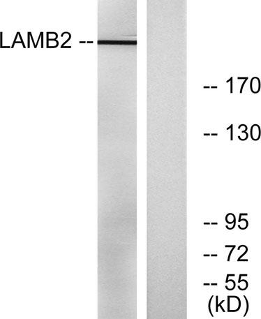 Western blot analysis of lysates from RAW264.7 cells, using LAMB2 Antibody. The lane on the right is blocked with the synthesized peptide.
