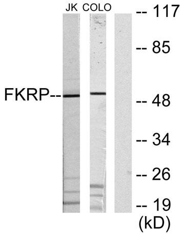 Western blot analysis of lysates from Jurkat and COLO205 cells, using FKRP Antibody. The lane on the right is blocked with the synthesized peptide.