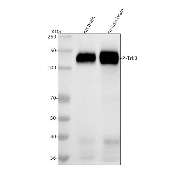 Western blot analysis of TrkB using anti-TrkB antibody.Electrophoresis was performed on a 5-20% SDS-PAGE gel at70V (Stacking gel) / 90V (Resolving gel) for 2-3 hours. The sample well of each lane was loaded with 30 ug of sample under reducing conditions.
Lane 1: rat brain tissue lysates,
Lane 2: mouse brain tissue lysates.
After electrophoresis, proteins were transferred to a nitrocellulose membrane at 150 mA for 50-90 minutes. Blocked the membrane with 5% non-fat milk/TBS for 1.5
hour at RT. The membrane was incubated with rabbit anti-TrkB antigen affinity purified monoclonal antibody at 1:500 overnight at 4°C, then washed with TBS-0.1%Tween 3 times with 5 minutes each and probed with a goat anti-rabbit IgG-HRP secondary antibody at a dilution of 1:500 for 1.5 hour at RT. The signal is developed using an Enhanced Chemiluminescent detection (ECL) kit with Tanon 5200 system. A specific band was detected for TrkB at approximately 140 kDa.
