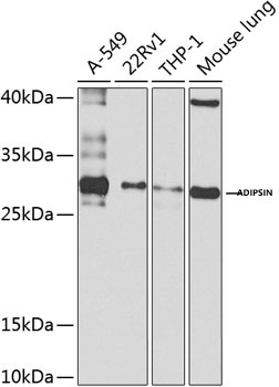 Western blot analysis of extracts of various cell lines, using Adipsin antibody  at1:1000 dilution._Secondary antibody: HRP Goat Anti-Rabbit IgG (H+L) at
1:10000 dilution._Lysates/proteins: 25μg per lane._Blocking buffer: 3% nonfat dry milk in TBST._Detection: ECL West Pico Plus._Exposure time: 20s.