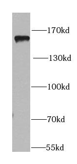 mouse brain tissue were subjected to SDS PAGE followed by western blot with (PER1 antibody) at dilution of 1:1000
