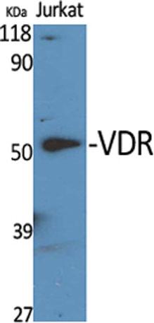 Western Blot analysis of various cells using VDR PolyclonalAntibody diluted at 1:500. Secondary antibody was diluted at 1:20000 cells nucleus extracted by Minute TM Cytoplasmic and Nuclear Fractionation kit