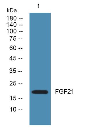 Western blot analysis of lysates from KB cells, primary antibody was diluted at 1:1000, 4°over night
