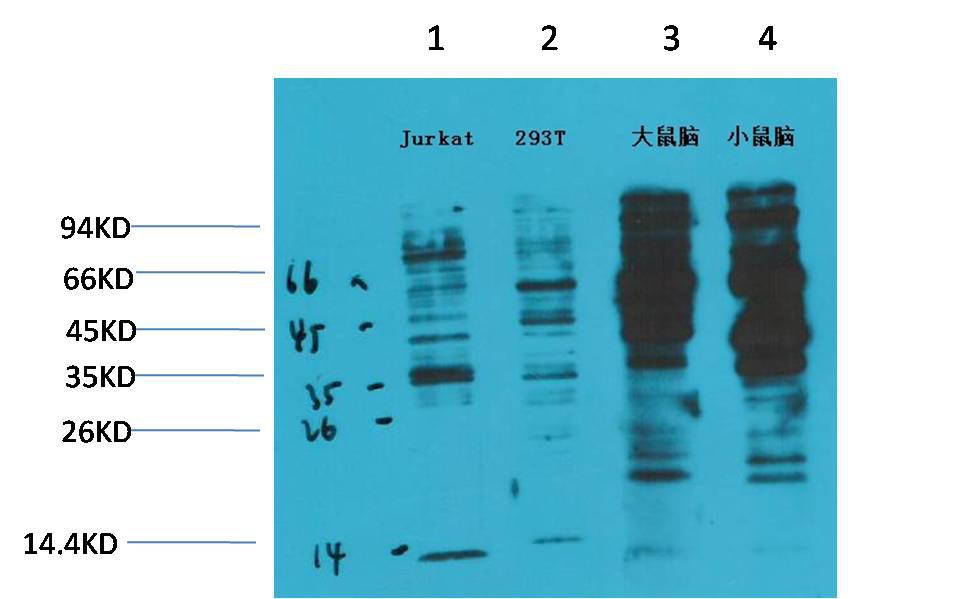 Western blot analysis of) Jurkat 2) 293T 3) Rat Brain Tissue 4) Mouse Brain Tissue with Phosphotyrosine Mouse mAb diluted at:2000.