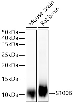 Western blot analysis of various lysates using S100B Rabbit mAb  at 1:1000 dilution incubated overnight at 4℃.
Secondary antibody: HRP-conjugated Goat anti-Rabbit IgG (H+L) at 1:10000 dilution.
Lysates/proteins: 25 μg per lane.
Blocking buffer: 3% nonfat dry milk in TBST.
Detection: ECL West Pico Plus.
Exposure time: 3s.