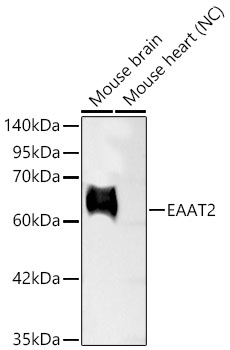 Western blot analysis of various lysates using EAAT2 Rabbit mAbat 1:9000 dilution.
Secondary antibody: HRP-conjugated Goat anti-Rabbit IgG (H+L)  at 1:10000 dilution.
Lysates/proteins: 25 μg per lane.
Blocking buffer: 3% nonfat dry milk in TBST.
Detection: ECL Basic Kit.
Negative control (NC): Mouse heart.
Exposure time: 30s.