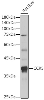 Western blot analysis of lysates from Rat liver, using CCR5 Rabbit pAb  at 1:1000 dilution.
Secondary antibody: HRP-conjugated Goat anti-Rabbit IgG (H+L)  at 1:10000 dilution.
Lysates/proteins: 25μg per lane.
Blocking buffer: 3% nonfat dry milk in TBST.
Detection: ECL Basic Kit.
Exposure time: 10s.