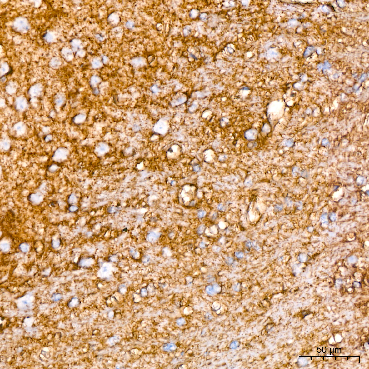 Immunohistochemistry analysis of paraffin-embedded Mouse brain tissue using EAAT1/SLC1A3 Rabbit mAb at a dilution of 1:200 (40x lens). High pressure antigen retrieval performed with 0.01M Citrate buffer (pH 6.0) prior to IHC staining.