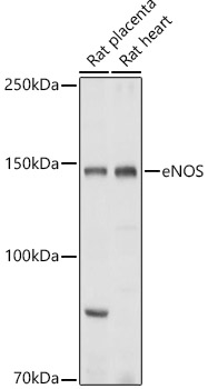 Western blot analysis of various lysates using eNOS Rabbit pAb at 1:1000 dilution.
Secondary antibody: HRP-conjugated Goat anti-Rabbit IgG (H+L) at 1:10000 dilution.
Lysates/proteins: 25μg per lane.
Blocking buffer: 3% nonfat dry milk in TBST.
Detection: ECL West Pico Plus.
Exposure time: 10s.