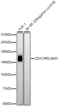 Western blot analysis of various lysates, using CD31/PECAM1 Rabbit mAb at 1:12500 dilution.
Secondary antibody: HRP-conjugated Goat anti-Rabbit IgG (H+L)at 1:10000 dilution.
Lysates/proteins: 25μg per lane.
Blocking buffer: 3% nonfat dry milk in TBST.
Detection: ECL Basic Kit
Negative control (NC): SK-BR-3
Exposure time: 180s.
