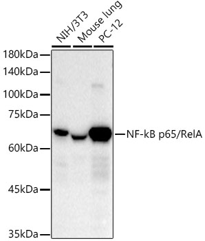 Western blot analysis of various lysates using [KO Validated] NF-kB p65/RelA Rabbit mAb at 1:10000 dilution.
Secondary antibody: HRP-conjugated Goat anti-Rabbit IgG (H+L at 1:10000 dilution.
Lysates/proteins: 25μg per lane.
Blocking buffer: 3% nonfat dry milk in TBST.
Detection: ECL West Pico Plus.
Exposure time: 30s.