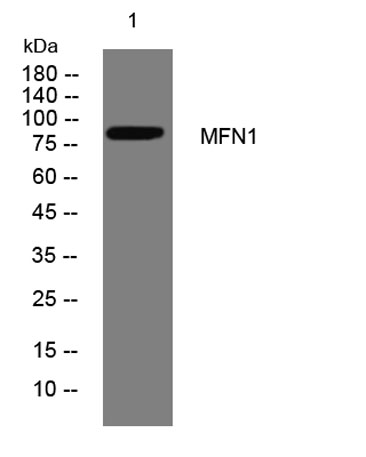 Western blot analysis of lysates from HCT116 cells, primary antibody was diluted at 1:1000, 4°over night