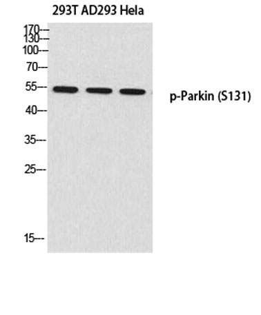 Western blot analysis of 293T AD293 Hela using p-Parkin (S131) antibody. Antibody was diluted at 1:500