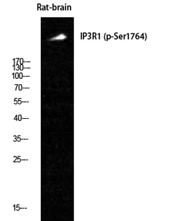 Western Blot analysis of Rat-brain cells using Phospho-IP3R-I (S1764) Polyclonal Antibody