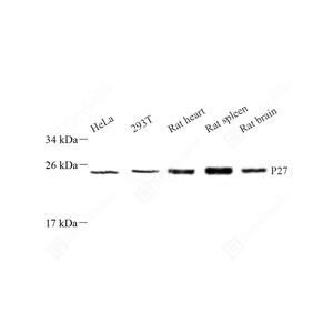 WB analysis of p27 KIP 1.Sample: Protein treated by RIPA Lysis Buffer .Blocking buffer: 3% Nonfat dry milk in TBST, RT, 1h.Primary antibody: 1: 1000, 4℃ overnight.Secondary antibody: HRP conjugated Goat Anti-Rabbit lgG , 1: 5000, RT, 1h.