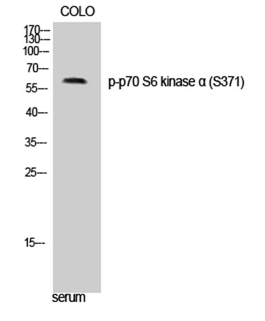 Western Blot analysis of COLO cells using Phospho-p70 S6 kinase α (S371) Polyclonal Antibody diluted at 1:500