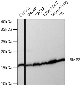 Western blot analysis of various lysates using BMP2 Rabbit mAb  at 1:1000 dilution incubated at room temperature for 1.5 hours.
Secondary antibody: HRP-conjugated Goat anti-Rabbit IgG (H+L)  at 1:10000 dilution.
Lysates/proteins: 25 μg per lane.
Blocking buffer: 3% nonfat dry milk in TBST.
Detection: ECL Basic Kit (RM00020).
Exposure time: 1s.