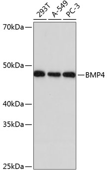 Western blot analysis of various lysates using BMP4 Rabbit mAb at 1:1000 dilution.
Secondary antibody: HRP-conjugated Goat anti-Rabbit IgG (H+L) at 1:10000 dilution.
Lysates/proteins: 25μg per lane.
Blocking buffer: 3% nonfat dry milk in TBST.
Detection: ECL West Pico Plus.
Exposure time: 10s.