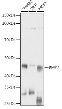 Western blot analysis of various lysates using BMP7 Rabbit pAb at 1:1000 dilution.
Secondary antibody: HRP-conjugated Goat anti-Rabbit IgG (H+L) at 1:10000 dilution.
Lysates/proteins: 25μg per lane.
Blocking buffer: 3% nonfat dry milk in TBST.
Detection: ECLWest Pico Plus.
Exposure time: 1s.
