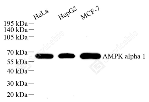 WB analysis of AMPK alpha 1. Sample: Protein treated by RIPA Lysis Buffer . Blocking buffer: 3% Nonfat dry milk in TBST, RT, 1h. Primary antibody: 1: 1500, 4℃ overnight. Secondary antibody: HRP conjugated Goat Anti-Rabbit lgG , 1: 3000, RT, 1h.