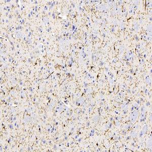 IHC analysis of Iba1.Sample: Mouse brain, 4% PFA 12-24h.Antigen retrieval: Citrate buffer , 98℃, 20 min.Primary antibody: 1: 2000, 4℃ overnight.Secondary antibody: HRP conjugated Goat Anti-Mouse lgG , 1: 200, RT, 1h.