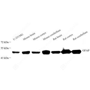 WB analysis of GFAP.Sample: Protein treated by RIPA Lysis Buffer .Blocking buffer: 3% Nonfat dry milk in TBST, RT, 1h.Primary antibody: 1: 1000, 4℃ overnight.Secondary antibody: HRP conjugated Goat Anti-Rabbit lgG , 1: 5000, RT, 1h.
