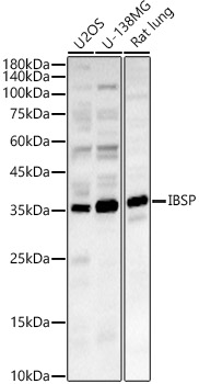 Western blot analysis of various lysates, using IBSP Rabbit pAb (AB-81521) at 1:2500 dilution.
Secondary antibody: HRP-conjugated Goat anti-Rabbit IgG (H+L) at 1:10000 dilution.
Lysates/proteins: 25μg per lane.
Blocking buffer: 3% nonfat dry milk in TBST.
Detection: ECL pico.
Exposure time: 90s.
