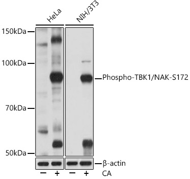 Western blot analysis of various lysates using Phospho-TBK1/NAK-S172 Rabbit mAb  at 1:1000 dilution. Both HeLa cells and NIH/3T3 cells were treated with Calyculin A (100 nM) at 37℃ for 30 minutes after serum-starvation overnight.
Secondary antibody: HRP-conjugated Goat anti-Rabbit IgG (H+L)  at 1:10000 dilution.
Lysates/proteins: 25μg per lane.
Blocking buffer: 3% BSA.
Detection: ECL West Pico Plus.   
Exposure time: 1min.