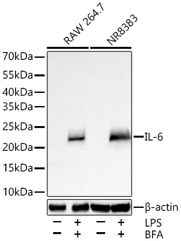 Western blot analysis of various lysates using IL-6 Rabbit PAb  at 1:5000 dilution incubated overnight at 4℃. RAW 264.7 cells and NR8383 cells were treated with LPS (1 μg/mL) and BFA (300 ng/mL) for 8 hours.
Secondary antibody: HRP-conjugated Goat anti-Rabbit IgG (H+L)  at 1:10000 dilution.
Lysates/proteins: 30 μg per lane.
Blocking buffer: 3% nonfat dry milk in TBST.
Detection: ECL West Pico Plus.
Exposure time: 45 s.