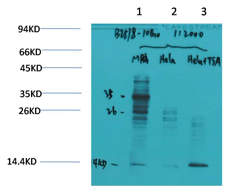 Western blot analysis of 1) Mouse Brain Tissue, 2)Hela, 3)Hela+TSA Treated with Acetyl Lysine Mouse mAb diluted at 1:2,000.