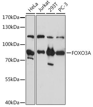 Western blot analysis of various lysates using FOXO3A Rabbit pAb at 1:1000 dilution.
Secondary antibody: HRP-conjugated Goat anti-Rabbit IgG (H+L) at 1:10000 dilution.
Lysates/proteins: 25μg per lane.
Blocking buffer: 3% nonfat dry milk in TBST.
Detection: ECL West Pico Plus.
Exposure time: 5s.